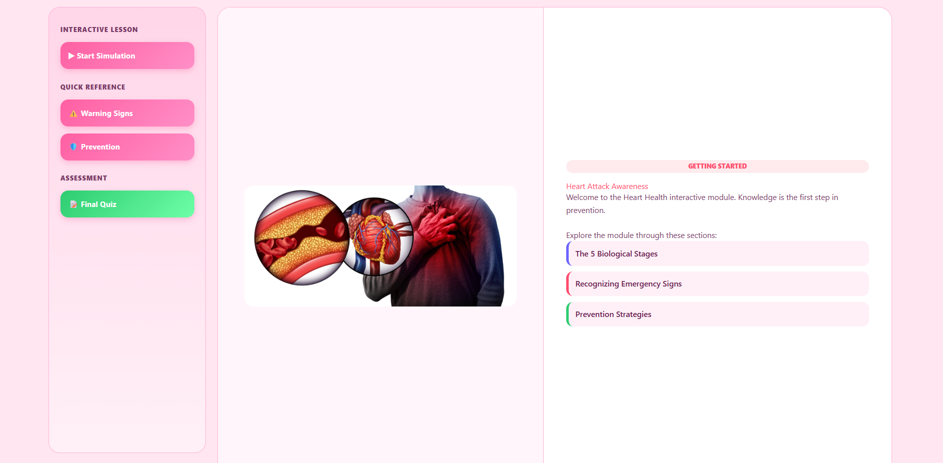 Heart attack