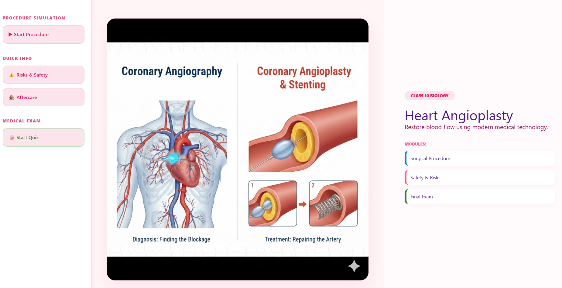 Angiography, Coronary angioplasty and stenting