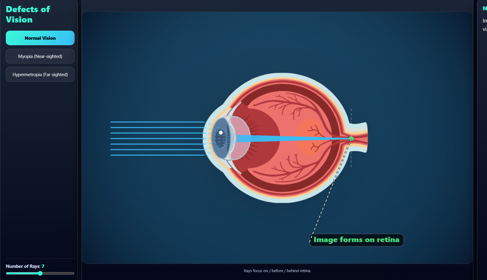 Defects of vision
