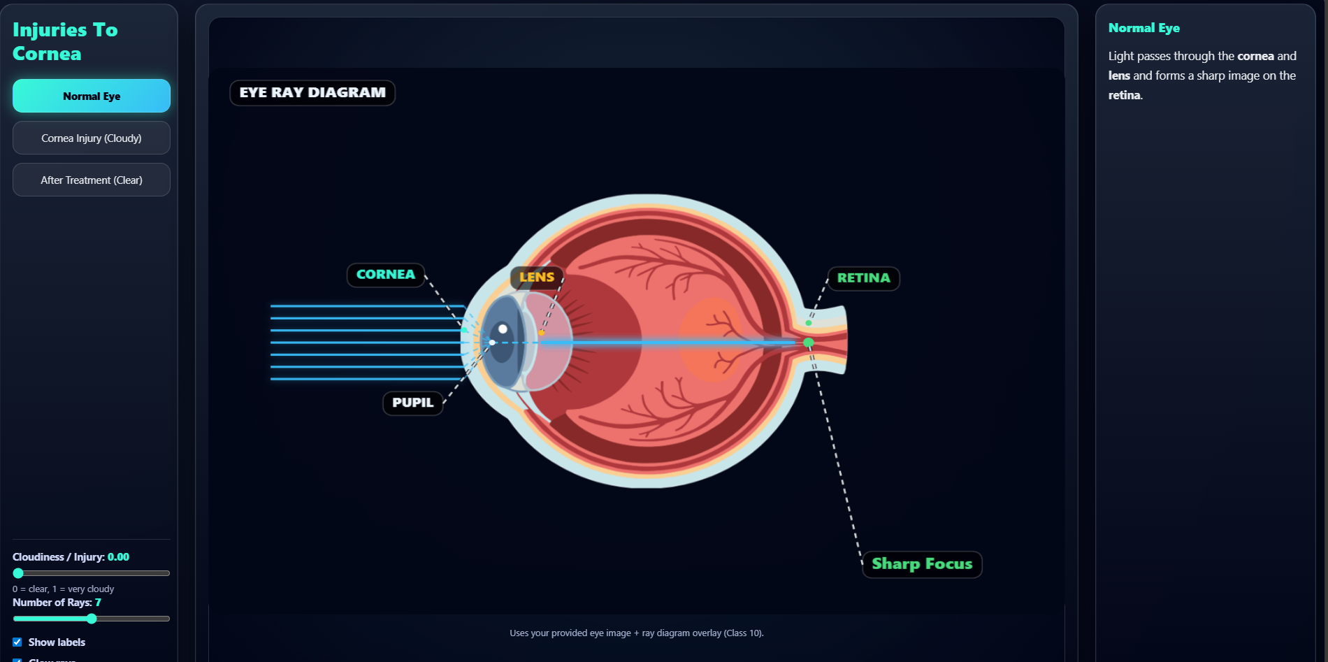 Effects of injuries to the cornea in the eyes