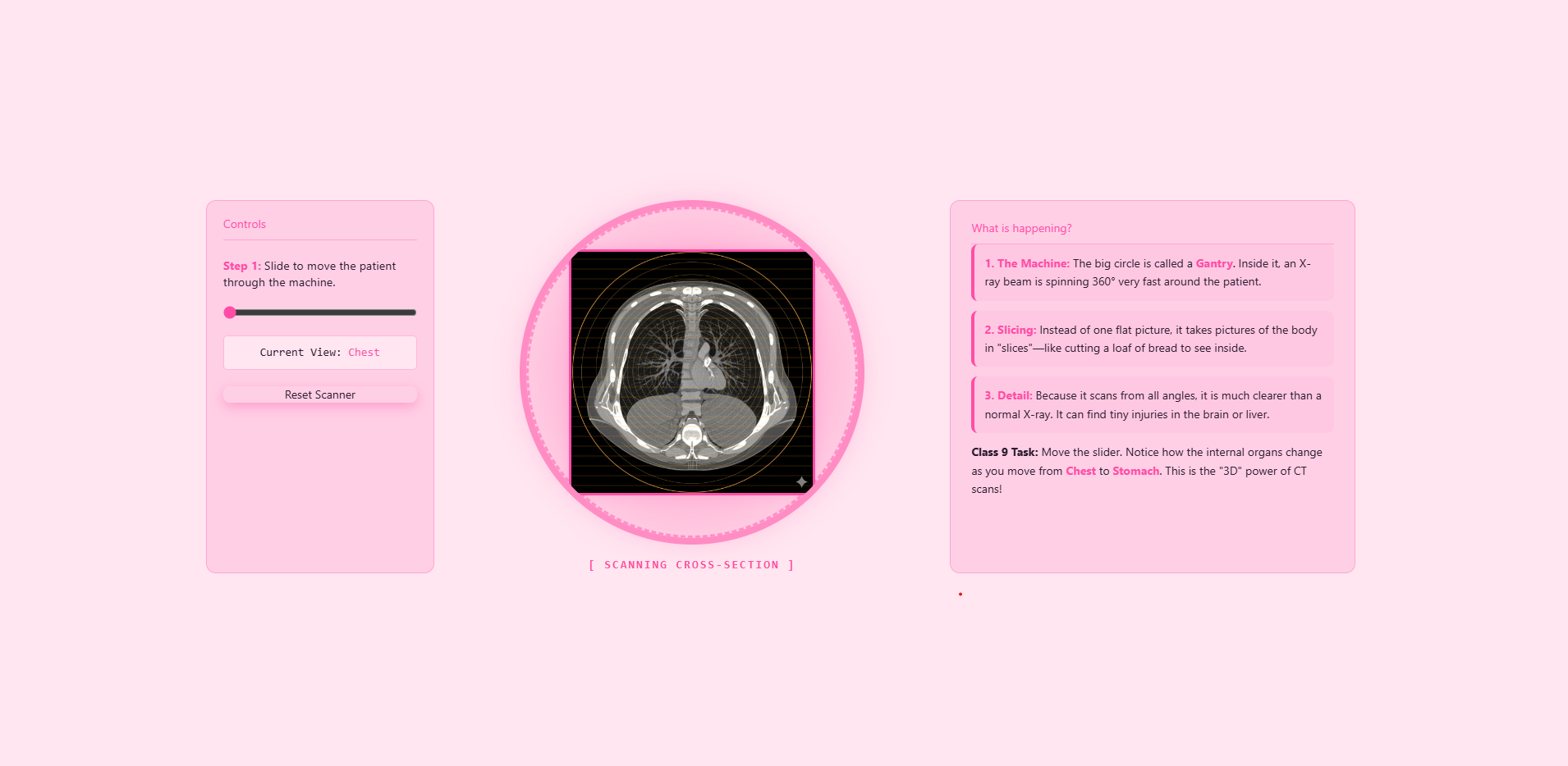 CT scan